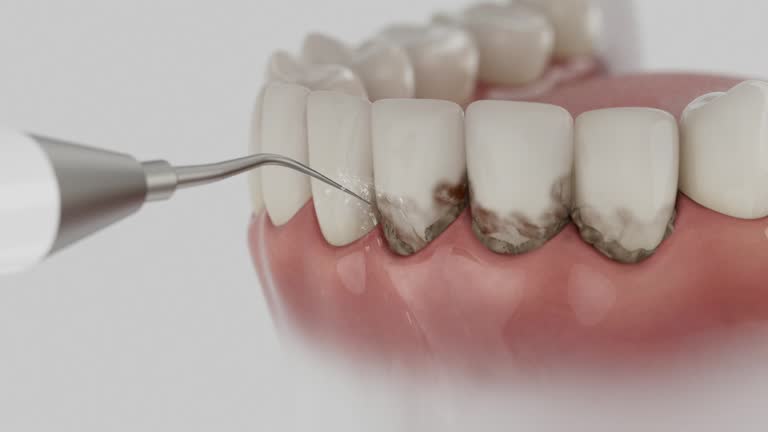 Reliable Dental Implants contractor in Mill Valley, CA by Smile Center Dentistry